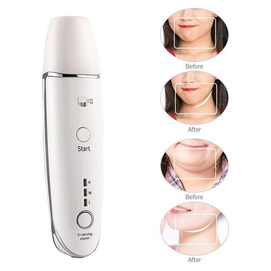 V-Shape Anti-Aging Skin Care Beauty Device